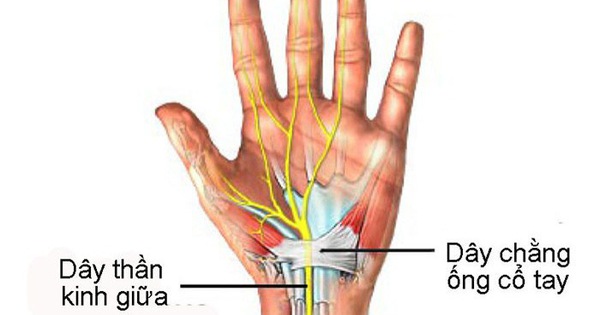 Cách massage bấm huyệt trị hội chứng ống cổ tay